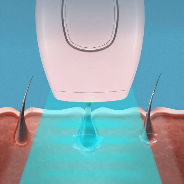 EternaGlow IPL Laser Facial & Whole Body Hair Removal Handset